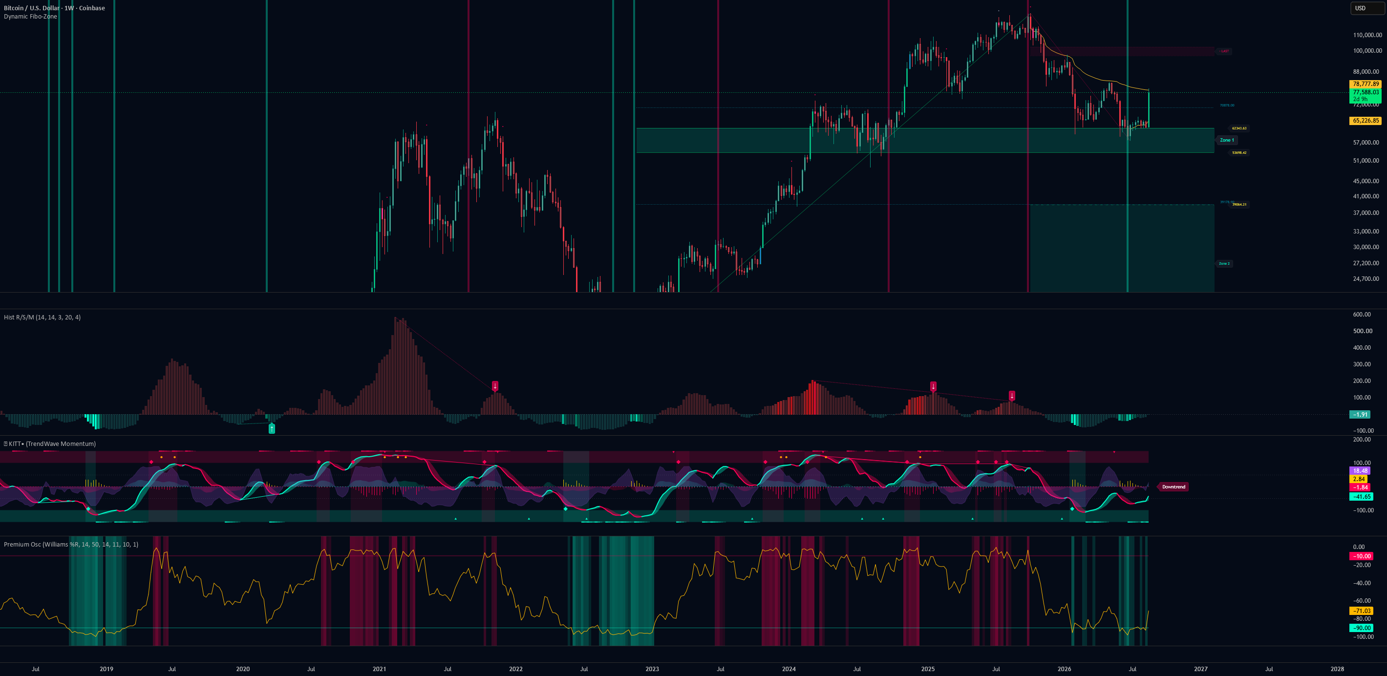 Dynamic Histogram R/S/M -